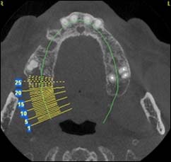 Les maladies des gencives